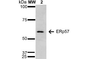 Western Blot analysis of Human Cervical Cancer cell line (HeLa) showing detection of 57 kDa Erp57 protein using Mouse Anti-Erp57 Monoclonal Antibody, Clone 4F9 . (PDIA3 anticorps  (AA 25-505) (Atto 594))