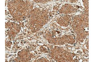 Immunohistochemistry analysis using Rabbit Anti-ROR1 Polyclonal Antibody (ABIN5667786). (ROR1 anticorps  (AA 200-300) (Atto 594))