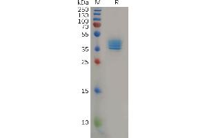 Human Protein, hFc Tag on SDS-PAGE under reducing condition. (CCR4 Protein (AA 1-39) (Fc Tag))