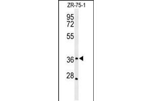 Western blot analysis of MIIP Antibody in ZR-75-1 cell line lysates (35ug/lane) (MIIP anticorps  (C-Term))