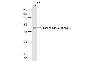 Mouse Embryo lysates probed with Phospho-cdc25A (Ser76) Polyclonal Antibody, Unconjugated  at 1:500 dilution and 4˚C overnight incubation. (CDC25A anticorps  (pSer76))