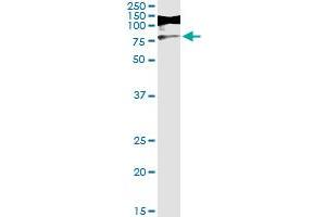 Immunoprecipitation of RIOK3 transfected lysate using mouse monoclonal anti-RIOK3 and Protein A Magnetic Bead (RIOK3 (Humain) IP-WB Antibody Pair)