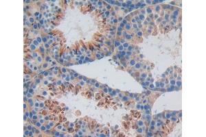 Used in DAB staining on fromalin fixed paraffin- embedded Kidney tissue (RIPK2 anticorps  (AA 1-294))