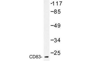 Image no. 1 for anti-CD83 (CD83) antibody (ABIN272283) (CD83 anticorps)