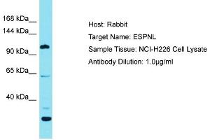 Host: Rabbit Target Name: ESPNL Sample Tissue: Human NCI-H226 Whole Cell Antibody Dilution: 1ug/ml (ESPNL anticorps  (C-Term))
