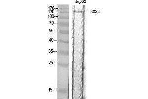 Western Blot (WB) analysis of HepG2 cells using NOS3 Polyclonal Antibody. (ENOS anticorps  (Thr180))