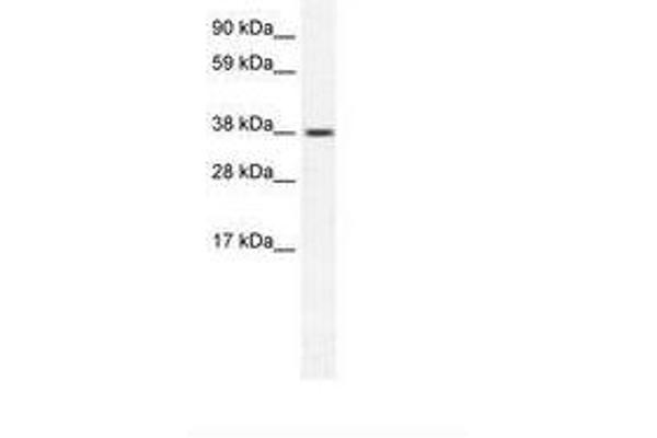 TRPM3 anticorps  (AA 201-250)