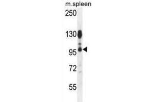 Western Blotting (WB) image for anti-ArfGAP with Coiled-Coil, Ankyrin Repeat and PH Domains 1 (ACAP1) antibody (ABIN2996040) (ACAP1 anticorps)