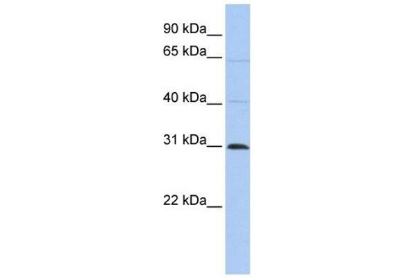 METTL11B anticorps  (C-Term)