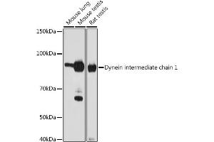Western blot analysis of extracts of various cell lines, using Dynein intermediate chain 1 antibody (ABIN1681261, ABIN7101535, ABIN7101536 and ABIN7101537) at 1:1000 dilution. (DNAI1 anticorps)