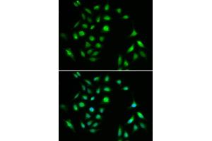 Immunofluorescence analysis of A549 cell using CHUK antibody. (IKK alpha anticorps)
