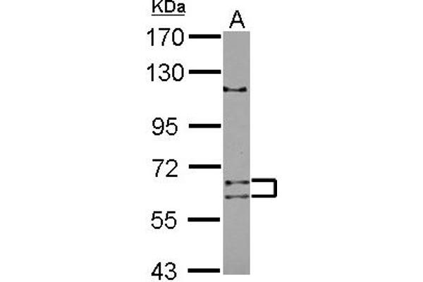 ADAD1 anticorps  (AA 1-307)