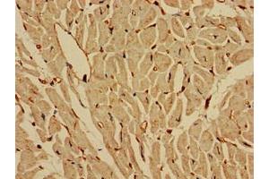 Immunohistochemistry of paraffin-embedded human heart tissue using ABIN7157046 at dilution of 1:100 (IREB2 anticorps  (AA 107-216))