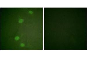 Immunofluorescence analysis of HeLa cells, using Retinoblastoma (Phospho-Ser249) Antibody. (Retinoblastoma Protein (Rb) anticorps  (pSer249))