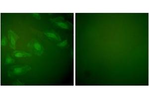 Immunofluorescence analysis of HeLa cells, using DJ-1 Antibody. (PARK7/DJ1 anticorps  (AA 21-70))