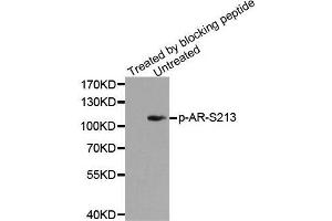 Western blot analysis of extracts from DU145 cells using Phospho-AR-S213 antibody. (Androgen Receptor anticorps  (pSer213))