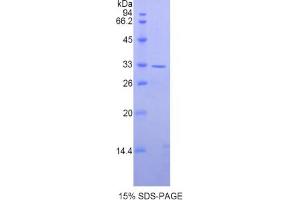 SDS-PAGE analysis of Human AXIN2 Protein. (AXIN2 Protéine)