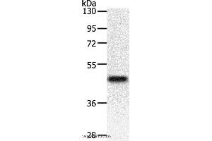 Western blot analysis of Mouse heart tissue, using PDK2 Polyclonal Antibody at dilution of 1:500 (PDK2 anticorps)