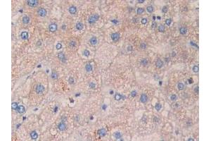 DAB staining on IHC-P; Samples: Human Liver Tissue. (CYFRA21.1 anticorps  (AA 244-400))