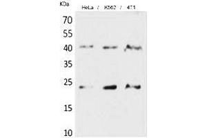 Western Blot analysis of hela, K562, 4T1 cells using TMEM173 Polyclonal Antibody. (STING/TMEM173 anticorps  (C-Term))