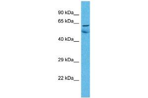 Host:  Rabbit  Target Name:  ZNF48  Sample Type:  Lung Tumor lysates  Antibody Dilution:  1. (ZNF48 anticorps  (C-Term))