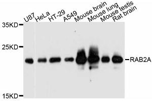 Western blot analysis of extracts of various cell lines, using RAB2A antibody (ABIN5998650) at 1:3000 dilution. (RAB2A anticorps)