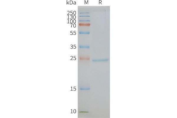 CD81 Protein (CD81)