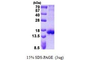 Image no. 1 for Cytotoxic T-Lymphocyte-Associated Protein 4 (CTLA4) protein (His tag) (ABIN1098772) (CTLA4 Protein (His tag))