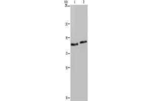 Western Blotting (WB) image for anti-Integrin beta 2 (ITGB2) antibody (ABIN2430320) (Integrin beta 2 anticorps)
