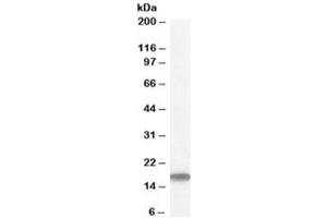 Western blot testing of human testis lysate with STMN1 antibody at 1ug/ml. (Stathmin 1 anticorps)
