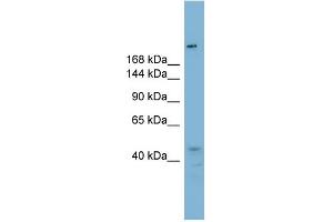WB Suggested Anti-RBBP6 Antibody Titration:  0. (RBBP6 anticorps  (N-Term))
