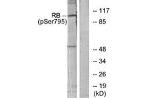 Western Blotting (WB) image for anti-Retinoblastoma Protein (Rb Protein) (pSer795) antibody (ABIN2888520) (Retinoblastoma Protein (Rb) anticorps  (pSer795))