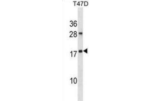 Western Blotting (WB) image for anti-ADP-Ribosylation Factor-Like 2 (ARL2) antibody (ABIN2998892) (ARL2 anticorps)