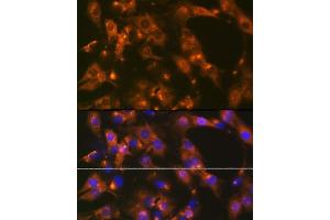Immunofluorescence analysis of C6 cells using  Rabbit mAb (ABIN1681069, ABIN3018897, ABIN3018898 and ABIN7101684) at dilution of 1:100 (40x lens). (alpha Adaptin anticorps)