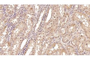 Detection of CRYl1 in Human Kidney Tissue using Monoclonal Antibody to Crystallin Lambda 1 (CRYl1) (CRYL1 anticorps  (AA 1-319))