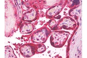 Anti-Luteinizing Hormone antibody IHC of human placenta. (Luteinizing Hormone anticorps)