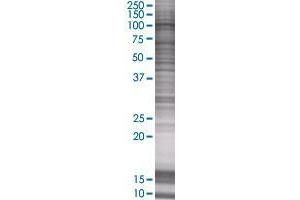 GBA2 transfected lysate. (GBA2 293T Cell Transient Overexpression Lysate(Denatured))