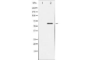 Western Blotting (WB) image for anti-ELK1, Member of ETS Oncogene Family (ELK1) antibody (ABIN1846330) (ELK1 anticorps)