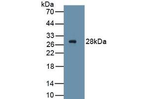 Detection of Recombinant PDGFRa, Human using Monoclonal Antibody to Platelet Derived Growth Factor Receptor Alpha (PDGFRa) (PDGFRA anticorps  (AA 170-387))