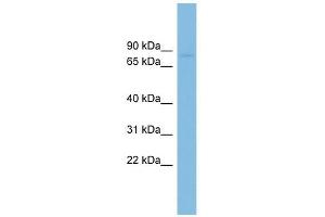 RAI16 antibody used at 1 ug/ml to detect target protein. (FAM160B2 anticorps  (N-Term))