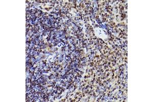 Immunohistochemistry of paraffin-embedded mouse spleen using MEF2A+MEF2C Rabbit mAb (ABIN1679049, ABIN1679050, ABIN7101495 and ABIN7101496) at dilution of 1:100 (40x lens). (MEF2A+MEF2C anticorps)