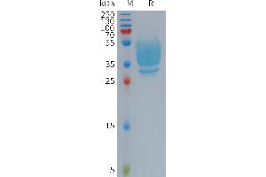 Human Protein, hFc Tag on SDS-PAGE under reducing condition. (GPR20 Protein (AA 1-48) (Fc Tag))