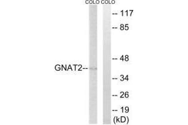 GNAT2 anticorps