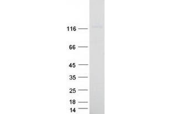 PCDH20 Protein (Myc-DYKDDDDK Tag)