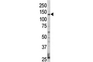 Western blot analysis of ErbB4 / HER4 antibody and HL-60 cell lysate. (ERBB4 anticorps  (AA 25-55))