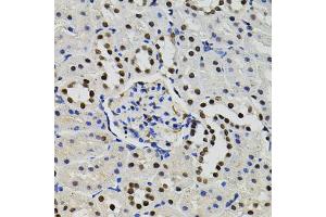 Immunohistochemistry of paraffin-embedded rat kidney using GTF2I antibody (ABIN5995399) (40x lens). (GTF2I anticorps)