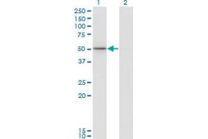 Western Blotting (WB) image for anti-Phosphoinositide 3 Kinase, p85 alpha (PI3K p85a) (AA 1-454) antibody (ABIN518903)