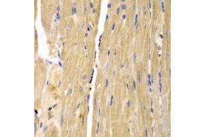 Immunohistochemistry of paraffin-embedded mouse heart using SLC25A13 antibody. (slc25a13 anticorps)