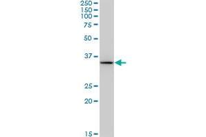 BDH1 monoclonal antibody (M03), clone 4B3. (BDH1 anticorps  (AA 1-343))