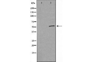 Western blot analysis of extracts from 293 cell, using GSDMC antibody. (MLZE anticorps  (Internal Region))